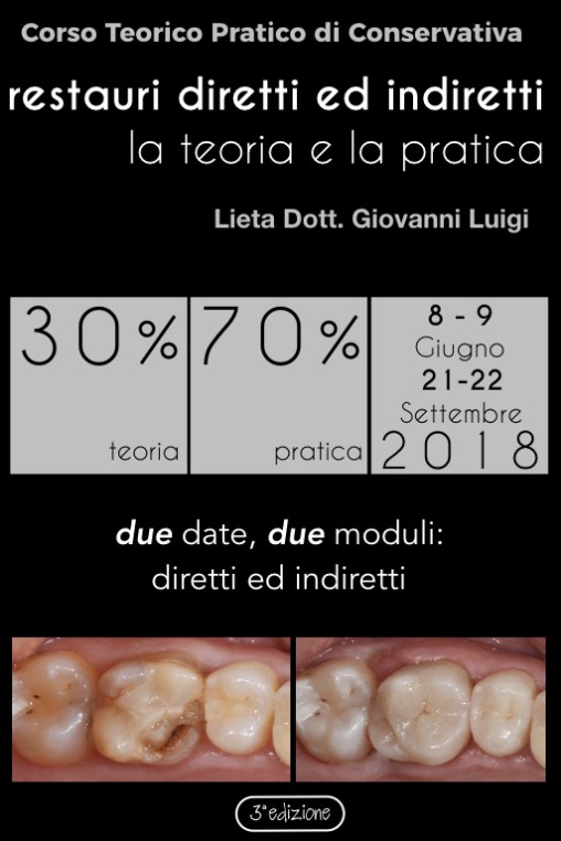 Corsi Esserre
